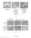 Fig. 04 - INDUCTION OF NEURONAL DIFFERENTIATION IN NON-NEURONAL CELLS  USING A NUCLEIC ACID MOLECULE