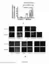 Fig. 06 - INDUCTION OF NEURONAL DIFFERENTIATION IN NON-NEURONAL CELLS  USING A NUCLEIC ACID MOLECULE