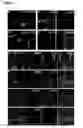 Fig. 05 - Tctex-1 regulatory sequence as stem cell marker