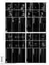 Fig. 08 - Tctex-1 regulatory sequence as stem cell marker