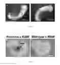 Fig. 03 - PNMT as a novel marker for progenitor cells