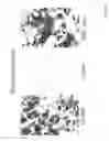 Fig. 05 - DIAGNOSIS AND TREATMENT OF NEUROECTODERMAL TUMORS