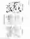 Fig. 06 - DIAGNOSIS AND TREATMENT OF NEUROECTODERMAL TUMORS