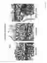 Fig. 14 - DIAGNOSIS AND TREATMENT OF NEUROECTODERMAL TUMORS