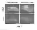 Fig. 02 - COMPOSITIONS AND METHODS COMPRISING VEGFR-2 AND VEGFR-3 ANTAGONISTS FOR THE TREATMENT OF METASTATIC DISEASE