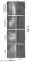 Fig. 09 - COMPOSITIONS AND METHODS COMPRISING VEGFR-2 AND VEGFR-3 ANTAGONISTS FOR THE TREATMENT OF METASTATIC DISEASE