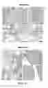 Fig. 12 - COMPOSITIONS AND METHODS COMPRISING VEGFR-2 AND VEGFR-3 ANTAGONISTS FOR THE TREATMENT OF METASTATIC DISEASE