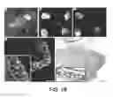 Fig. 19 - COMPOSITIONS AND METHODS COMPRISING VEGFR-2 AND VEGFR-3 ANTAGONISTS FOR THE TREATMENT OF METASTATIC DISEASE