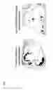 Fig. 05 - SUPPRESSANT FOR ATHEROSCLEROSIS