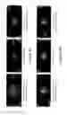 Fig. 04 - Antigen compositions and methods of inhibiting bacterial infection and uses of the antigen compositions
