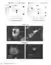 Fig. 01 - Modified gram-negative bacteria for use as vaccines