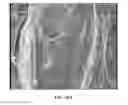 Fig. 11 - GEL BASED WOUND DRESSING AND A METHOD OF SYNTHESIZING THE SAME