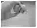 Fig. 01 - Method of obtaining viable small tissue particles and use for tissue repair