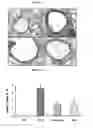 Fig. 05 - Pharmaceutical composition comprising an extract of and the catalpol derivatives isolated therefrom having antiinflammatory, antiallergic and antiasthmatic activity