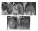 Fig. 01 - Compositions and functional foods for treating and preventing obesity using polygonum cuspidatum butanol fraction and ethyl acetate fraction
