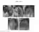 Fig. 15 - Compositions and functional foods for treating and preventing obesity using polygonum cuspidatum butanol fraction and ethyl acetate fraction