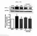 Fig. 46 - Compositions and functional foods for treating and preventing obesity using polygonum cuspidatum butanol fraction and ethyl acetate fraction