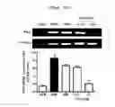Fig. 54 - Compositions and functional foods for treating and preventing obesity using polygonum cuspidatum butanol fraction and ethyl acetate fraction