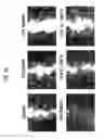 Fig. 10 - Anti-cancer composition comprising aquatic microbial extract