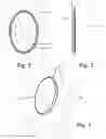 Fig. 02 - Plate attachment system