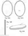 Fig. 11 - Plate attachment system