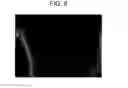Fig. 07 - Positive active material for rechargeable lithium battery, method of manufacturing the same and rechargeable lithium battery using the same