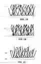 Fig. 02 - Electrode including nanostructures for rechargeable cells
