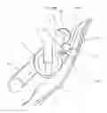 Fig. 01 - Orthodontic bracket with a pad