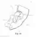 Fig. 05 - Orthodontic bracket with a pad