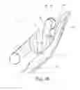 Fig. 06 - Orthodontic bracket with a pad