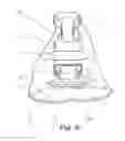 Fig. 07 - Orthodontic bracket with a pad