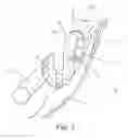 Fig. 11 - Orthodontic bracket with a pad