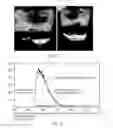 Fig. 03 - APPARATUS FOR DETECTING INFECTED TISSUE