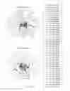 Fig. 05 - APPARATUS FOR DETECTING INFECTED TISSUE