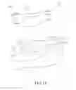 Fig. 20 - PROSTHETIC DENTAL DEVICE WITH BRIDGE HAVING CLASPING ARM