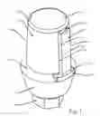 Fig. 02 - Dental Hydrostatic Relief Apparatus and Method