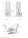 Fig. 12 - DENTAL TREATMENT APPARATUS AND METHOD