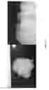 Fig. 24 - DECELLULARIZATION AND RECELLULARIZATION OF ORGANS AND TISSUES