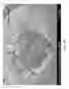 Fig. 31 - DECELLULARIZATION AND RECELLULARIZATION OF ORGANS AND TISSUES