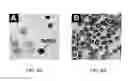 Fig. 12 - DETERMINATION OF FETAL ANEUPLOIDY BY QUANTIFICATION OF GENOMIC DNA FROM MIXED SAMPLES