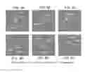 Fig. 13 - DETERMINATION OF FETAL ANEUPLOIDY BY QUANTIFICATION OF GENOMIC DNA FROM MIXED SAMPLES