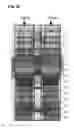Fig. 04 - BIOMARKER COMPOSITION FOR DETECTING DIABETIC RETINOPATHY AND DIAGNOSTIC KIT THEREFOR