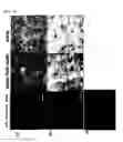 Fig. 09 - Method for culture of hepatocytes