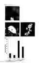 Fig. 14 - Method for culture of hepatocytes