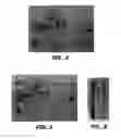 Fig. 04 - Enhanced protein expression in 
