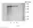 Fig. 03 - Reductase Enzymes