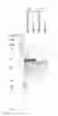 Fig. 11 - ENGINEERED MICROORGANISMS WITH ENHANCED FERMENTATION ACTIVITY