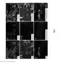 Fig. 08 - Method of in vitro differentiation of neural stem cells, motor neurons and dopamine neurons from primate embryonic stem cells