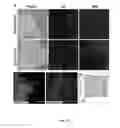 Fig. 11 - Method of in vitro differentiation of neural stem cells, motor neurons and dopamine neurons from primate embryonic stem cells