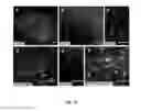 Fig. 13 - Method of in vitro differentiation of neural stem cells, motor neurons and dopamine neurons from primate embryonic stem cells